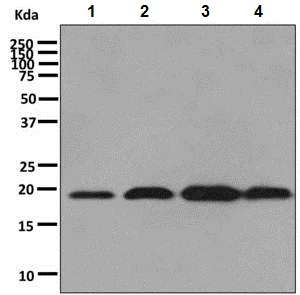 Western blot - Anti-dUTPase antibody [EPR9608(B)] (AB137097)
