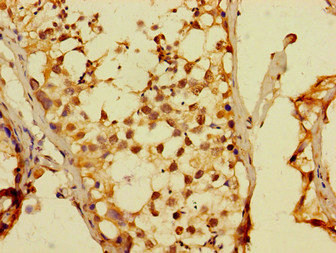 Immunohistochemistry (Formalin/PFA-fixed paraffin-embedded sections) - Anti-Dux4 antibody (AB229810)