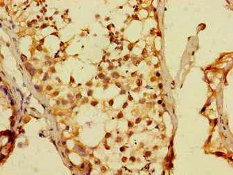 Immunohistochemistry (Formalin/PFA-fixed paraffin-embedded sections) - Anti-Dux4 antibody (AB229810)