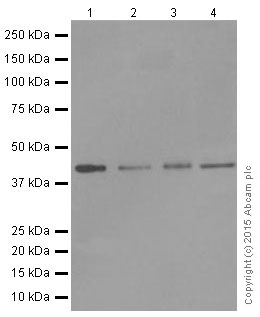 Western blot - Anti-Dux4 antibody [E5-5] (AB124699), expandable thumbnail