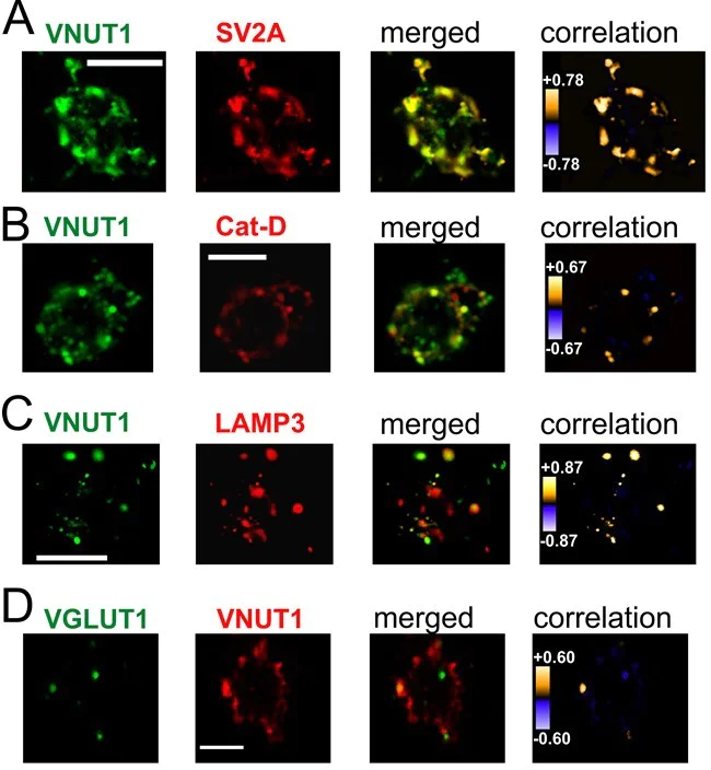 Fluorescence Microscopy - DyLight® 488 Conjugation Kit (Fast) - Lightning-Link® (AB201799)