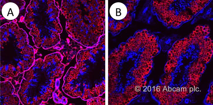 Conjugation - DyLight® 550 Conjugation Kit (Fast) - Lightning-Link® (AB201800)