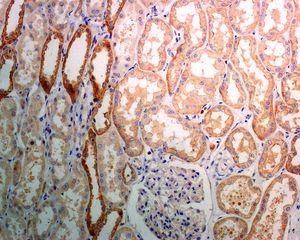 Immunohistochemistry (Formalin/PFA-fixed paraffin-embedded sections) - Anti-Dymeclin antibody [EPR8789] (AB133685), expandable thumbnail