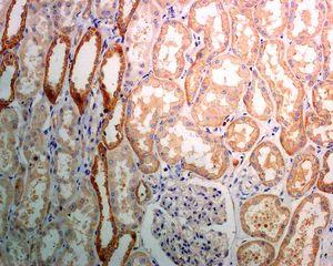 Immunohistochemistry (Formalin/PFA-fixed paraffin-embedded sections) - Anti-Dymeclin antibody [EPR8789] (AB133685)