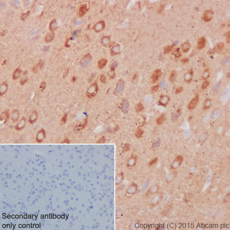 Immunohistochemistry (Formalin/PFA-fixed paraffin-embedded sections) - Anti-Dynamin 1 antibody [EP801Y] - BSA and Azide free (AB247322), expandable thumbnail