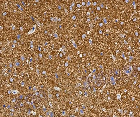 Immunohistochemistry (Formalin/PFA-fixed paraffin-embedded sections) - Anti-Dynamin 1 antibody [SR2307] (AB326686)