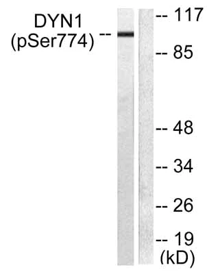 Western blot - Anti-Dynamin 1 (phospho S774) antibody (AB55324)