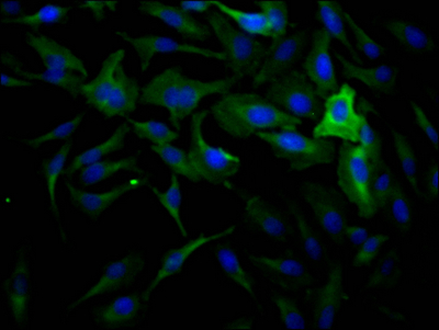 Immunocytochemistry/ Immunofluorescence - Anti-Dynamin 2 antibody [1D8] (AB314168), expandable thumbnail