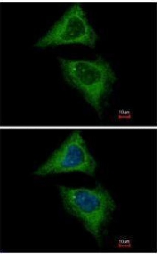 Immunocytochemistry/ Immunofluorescence - Anti-Dynamin 2 antibody (AB227192)