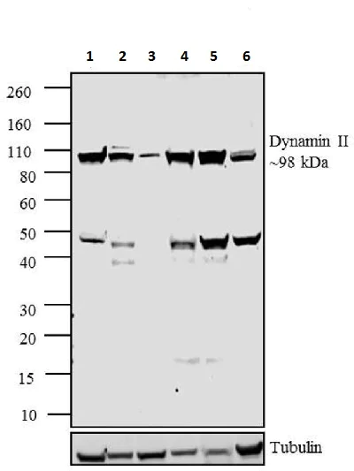 Western blot - Anti-Dynamin 2 antibody (AB3457)