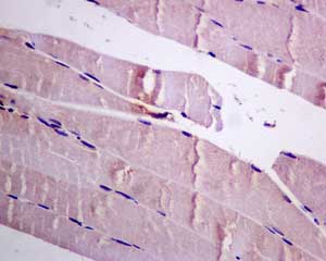 Immunohistochemistry (Formalin/PFA-fixed paraffin-embedded sections) - Anti-Dynamin 2 antibody [EPR9053(2)(ABC)] - BSA and Azide free (AB249002), expandable thumbnail
