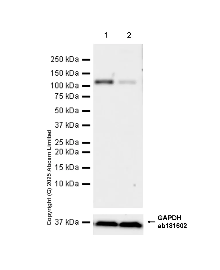 Western blot - Anti-Dynamin 2 antibody [EPR9053(2)(ABC)] - BSA and Azide free (AB249002)