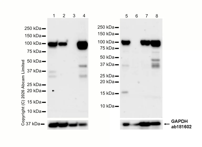 Western blot - Anti-Dynamin 2 antibody [EPR9053(2)(ABC)] - BSA and Azide free (AB249002)