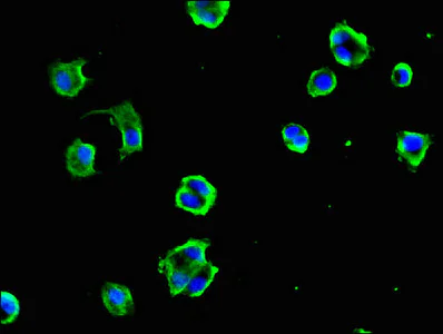 Immunocytochemistry/ Immunofluorescence - Anti-DYNC1H1 antibody (AB223060)
