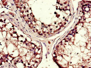 Immunohistochemistry (Formalin/PFA-fixed paraffin-embedded sections) - Anti-DYNC1H1 antibody (AB223060)