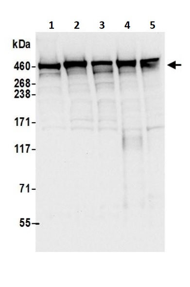 Western blot - Anti-DYNC1H1 antibody (AB245554)