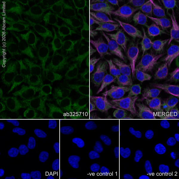 Immunocytochemistry/ Immunofluorescence - Anti-DYNC1H1 antibody [EPR30299-93] (AB325710)