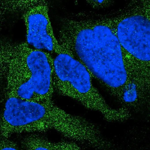 Immunocytochemistry/ Immunofluorescence - Anti-DYNC1I2 antibody (AB204422)