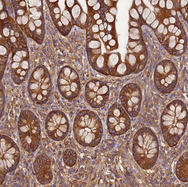 Immunohistochemistry (Formalin/PFA-fixed paraffin-embedded sections) - Anti-DYNC1I2 antibody (AB204422)