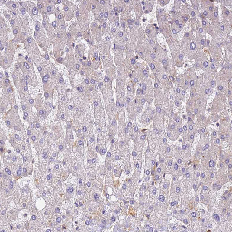 Immunohistochemistry (Formalin/PFA-fixed paraffin-embedded sections) - Anti-DYNC1I2 antibody (AB204422)