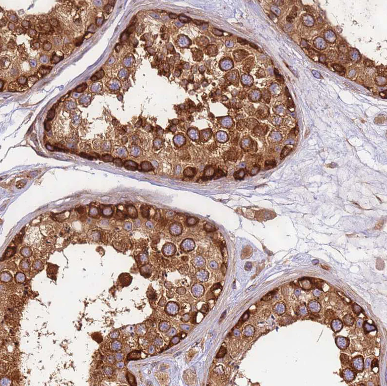 Immunohistochemistry (Formalin/PFA-fixed paraffin-embedded sections) - Anti-DYNC1I2 antibody (AB204422)