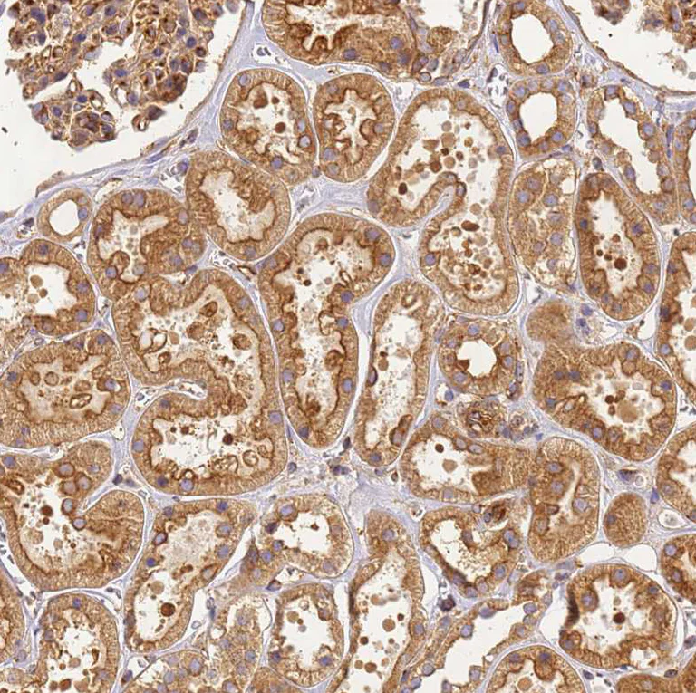 Immunohistochemistry (Formalin/PFA-fixed paraffin-embedded sections) - Anti-DYNC1I2 antibody (AB204422)