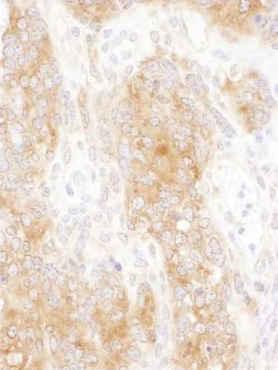 Immunohistochemistry (Formalin/PFA-fixed paraffin-embedded sections) - Anti-DYNC1I2 antibody - C-terminal (AB192920)