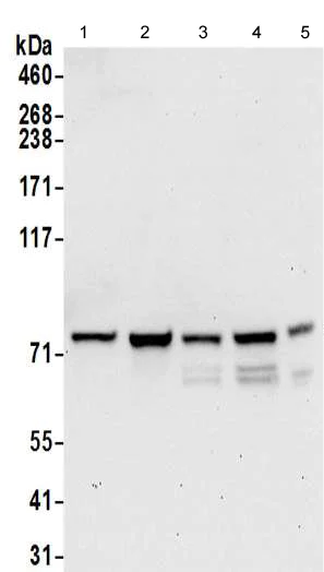 Western blot - Anti-DYNC1I2 antibody - C-terminal (AB192920)