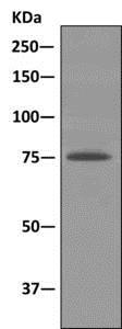 Immunoprecipitation - Anti-DYNC1I2 antibody [EPR11242] (AB167399), expandable thumbnail