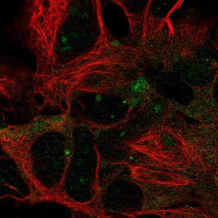 Immunocytochemistry/ Immunofluorescence - Anti-DYNC1LI2/LIC2 antibody (AB220844)