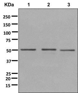 Western blot - Anti-DYNC1LI2/LIC2 antibody [EPR11230(2)] (AB178702)