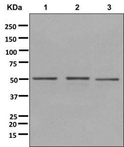 Western blot - Anti-DYNC1LI2/LIC2 antibody [EPR11230(2)] - BSA and Azide free (AB250074)