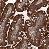 Immunohistochemistry (Formalin/PFA-fixed paraffin-embedded sections) - Anti-DYNC2H1 antibody (AB122525)