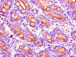 Immunohistochemistry (Formalin/PFA-fixed paraffin-embedded sections) - Anti-DYNC2H1 antibody (AB225946)