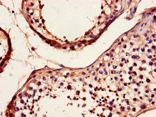 Immunohistochemistry (Formalin/PFA-fixed paraffin-embedded sections) - Anti-DYNC2H1 antibody (AB225946)
