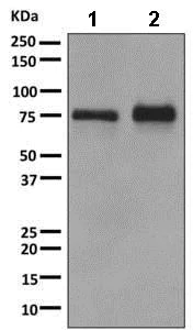 Western blot - Anti-Dynein intermediate chain 1/DNAI1 antibody [EPR11222] (AB156567)