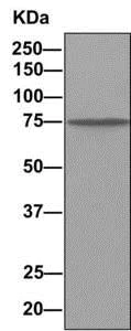 Immunoprecipitation - Anti-Dynein intermediate chain 1/DNAI1 antibody [EPR11222] - BSA and Azide free (AB249262)