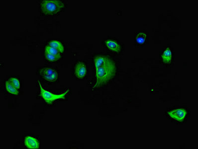 Immunocytochemistry/ Immunofluorescence - Anti-Dynein light chain antibody (AB236594)