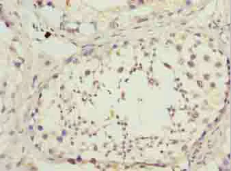 Immunohistochemistry (Formalin/PFA-fixed paraffin-embedded sections) - Anti-Dynein light chain antibody (AB236594)