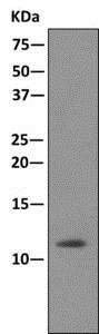 Immunoprecipitation - Anti-Dynein light chain antibody [EPR11234] - BSA and Azide free (AB249474), expandable thumbnail