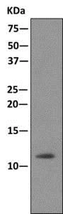 Immunoprecipitation - Anti-Dynein light chain antibody [EPR11234] - BSA and Azide free (AB249474)