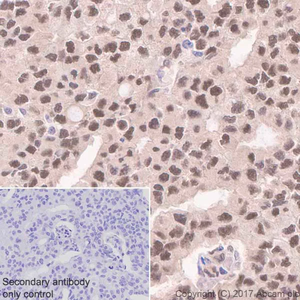 Immunohistochemistry (Formalin/PFA-fixed paraffin-embedded sections) - Anti-DYNLL1/PIN antibody [EP1660Y] (AB51603)