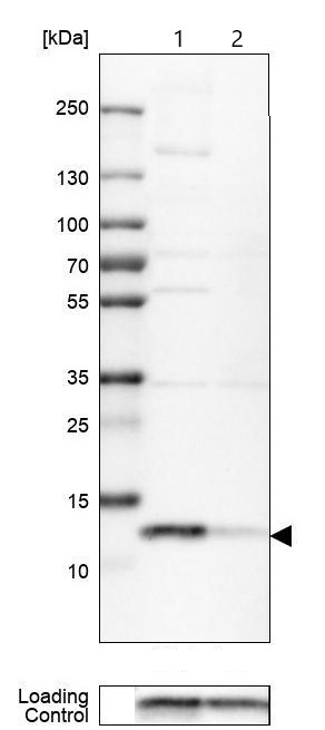 Western blot - Anti-DYNLT3 antibody (AB121209)