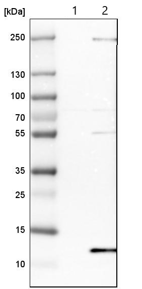 Western blot - Anti-DYNLT3 antibody (AB121209)