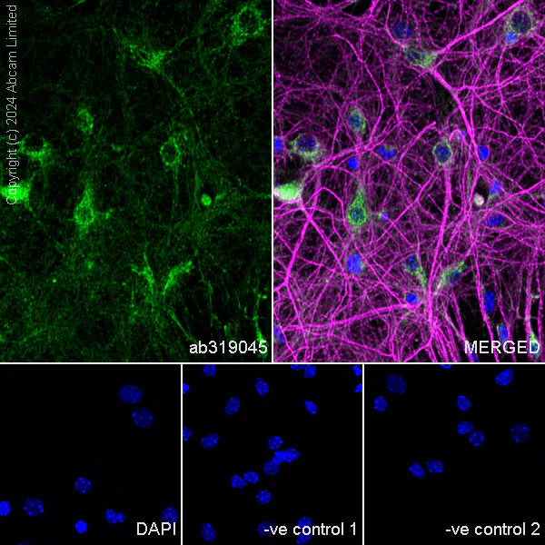 Immunocytochemistry/ Immunofluorescence - Anti-Dynorphin A antibody [EPR28632-17] (AB319045)