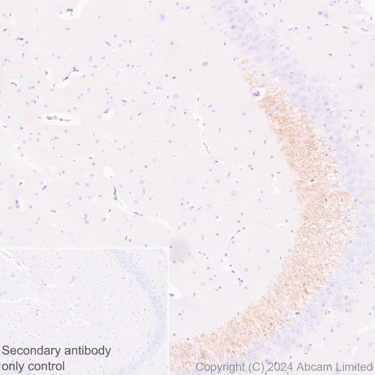 Immunohistochemistry (Formalin/PFA-fixed paraffin-embedded sections) - Anti-Dynorphin A antibody [EPR28632-17] (AB319045)