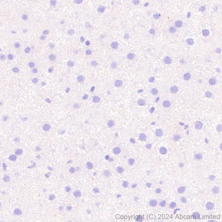 Immunohistochemistry (Formalin/PFA-fixed paraffin-embedded sections) - Anti-Dynorphin A antibody [EPR28632-17] (AB319045)