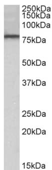 Western blot - Anti-DYRK1A antibody (AB156818)