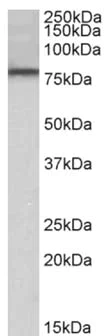 Western blot - Anti-DYRK1A antibody (AB156818)