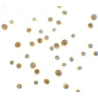 Immunocytochemistry - Anti-DYRK1A antibody - C-terminal (AB180910)